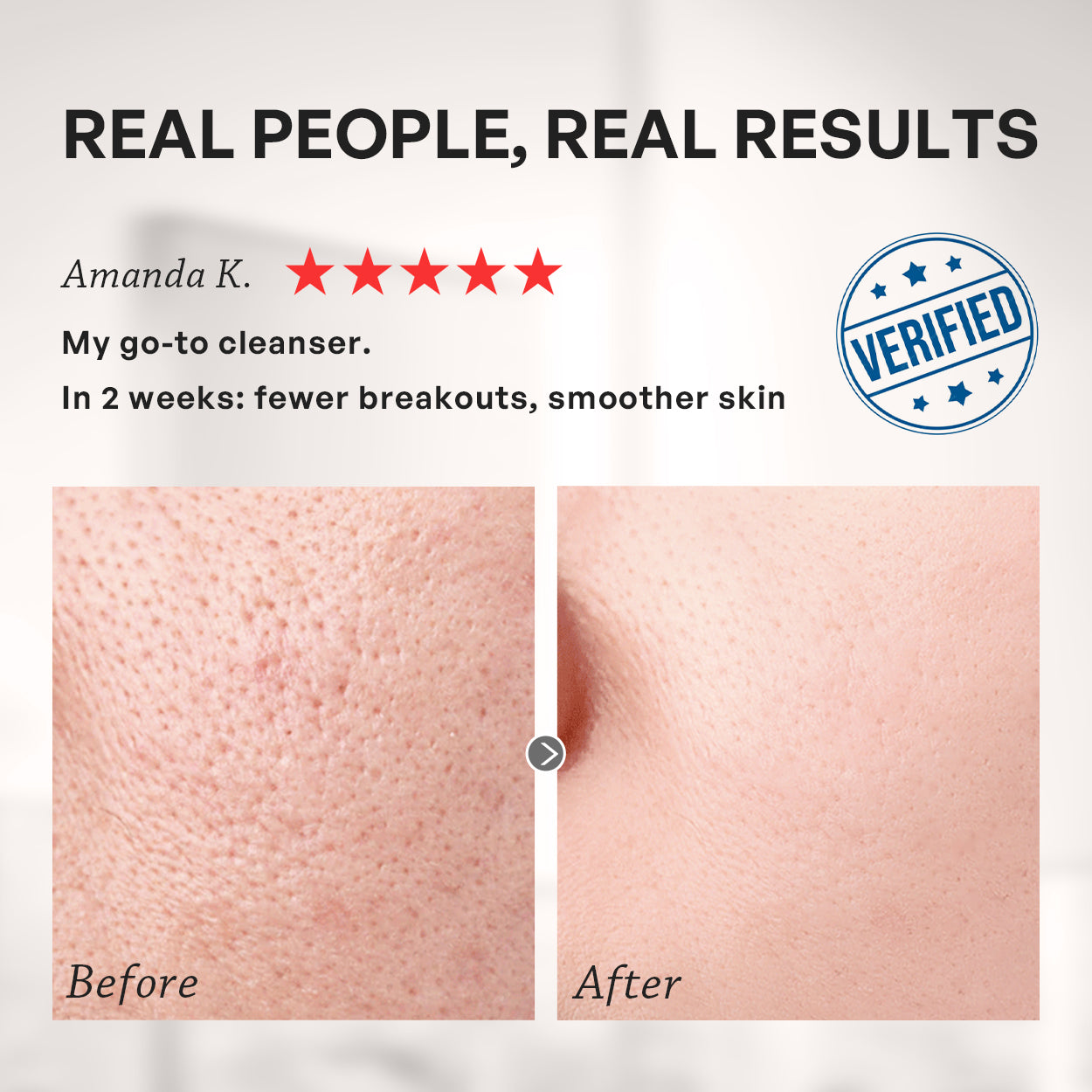 【TRUU】76 Probiotics Amino Purifying Cleanser