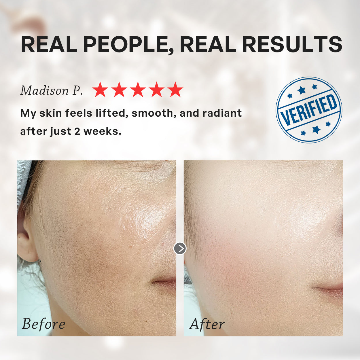 【TRUU】PDRN ExoRegenPro+™ Retinol Age-Renewal Lifting Cream