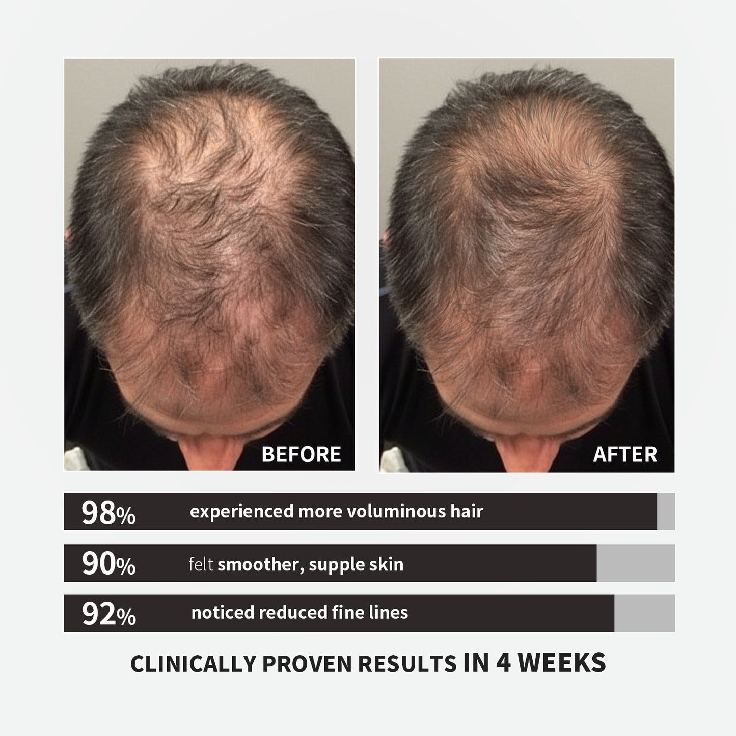 【ALLRE】Voluminous Fortifying Collagen (100g/bag)