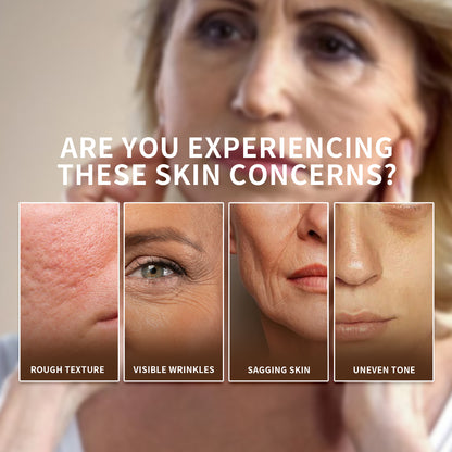 【ALLRE】Skin Repair Collagen C Complex(100g/bag)