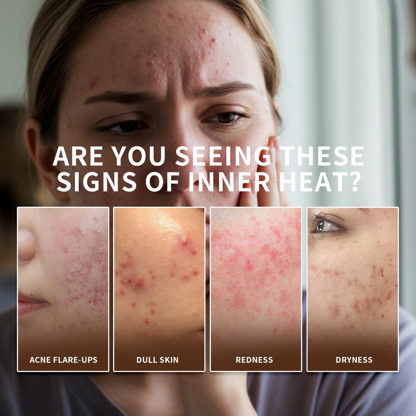 【ALLRE】Inner Balance Skin Calming Beauty Repair Capsule (30 capsules/bag)