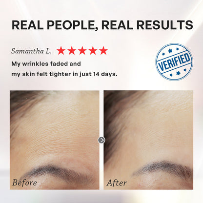 【TRUU】Pro Perfection Repair Essence -10ml Travel Size