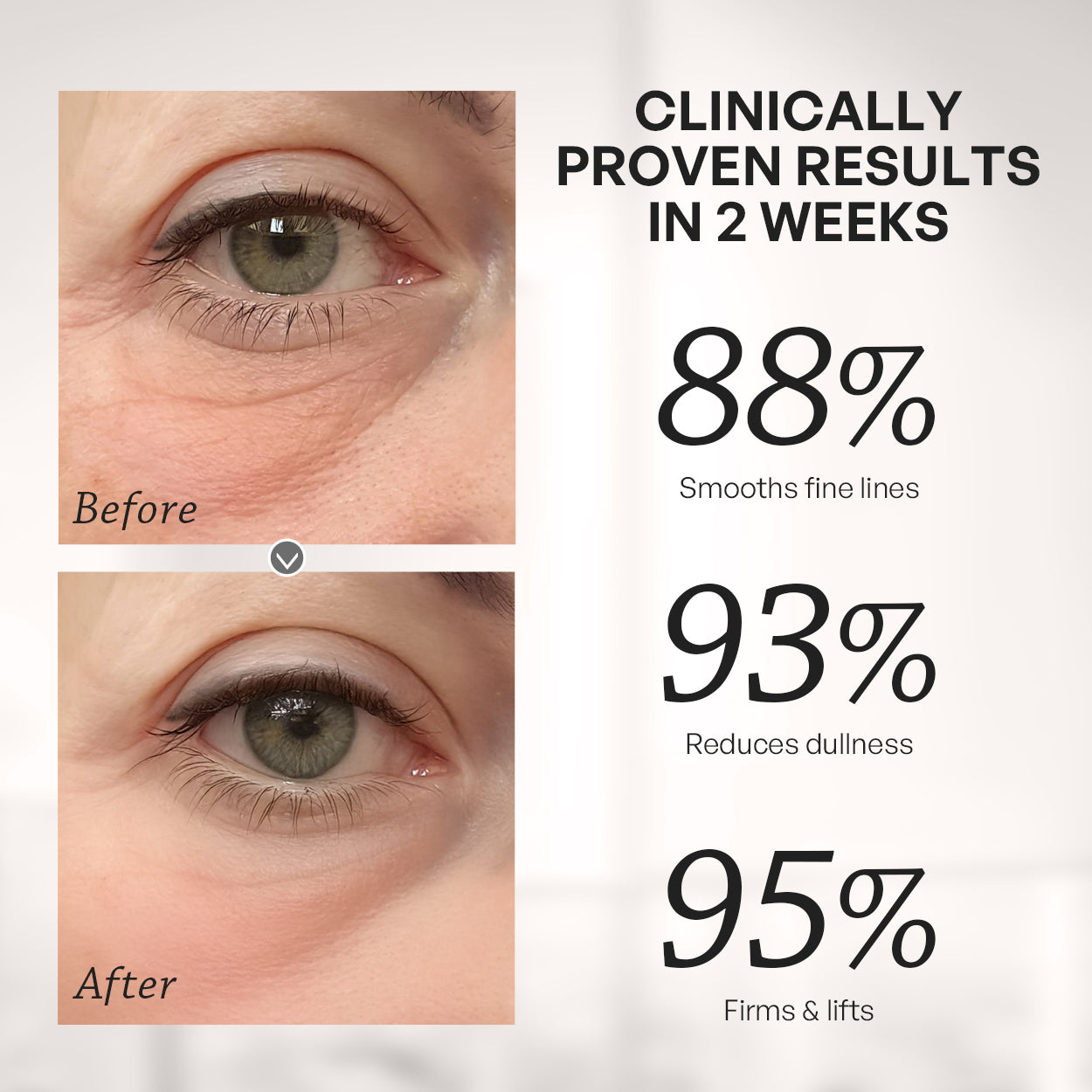 【TRUU】PDRN ExoRegenPro+™ Intensive Firming & Brightening Eye Mask