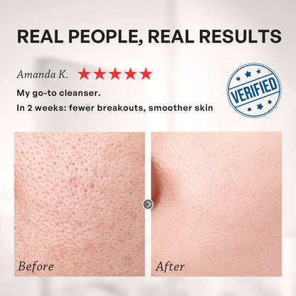 【TRUU】Royal Jelly Moisture Treatment Essence