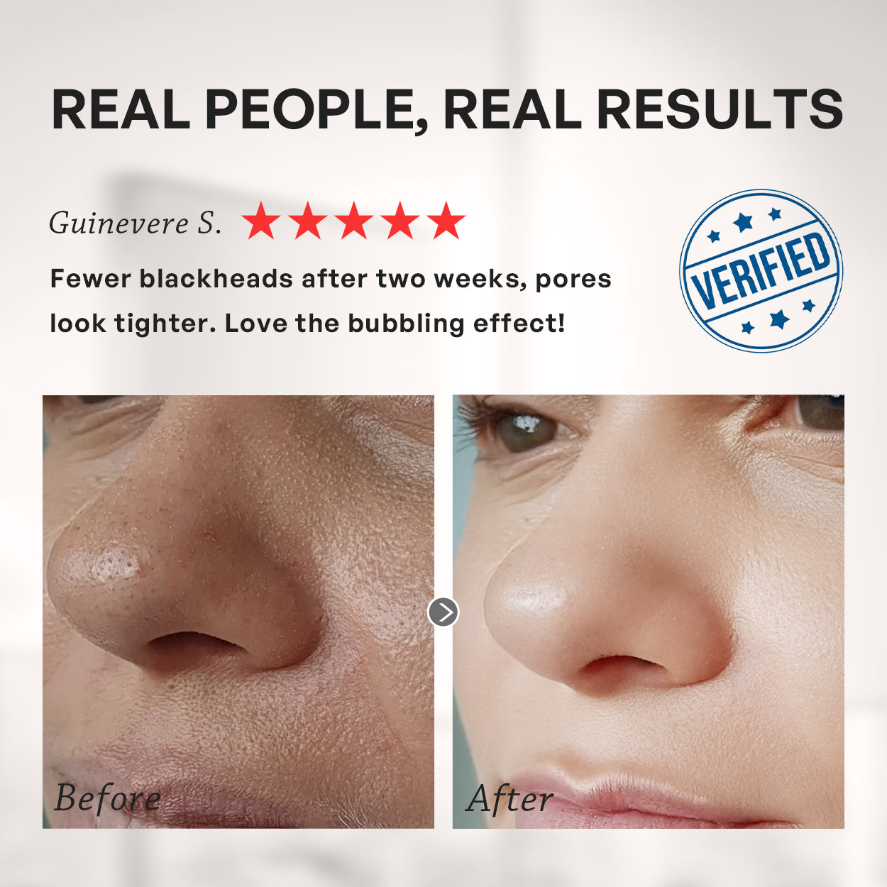 【TRUU】2% Salicylic Acid Pore Minimising Bubble Mask