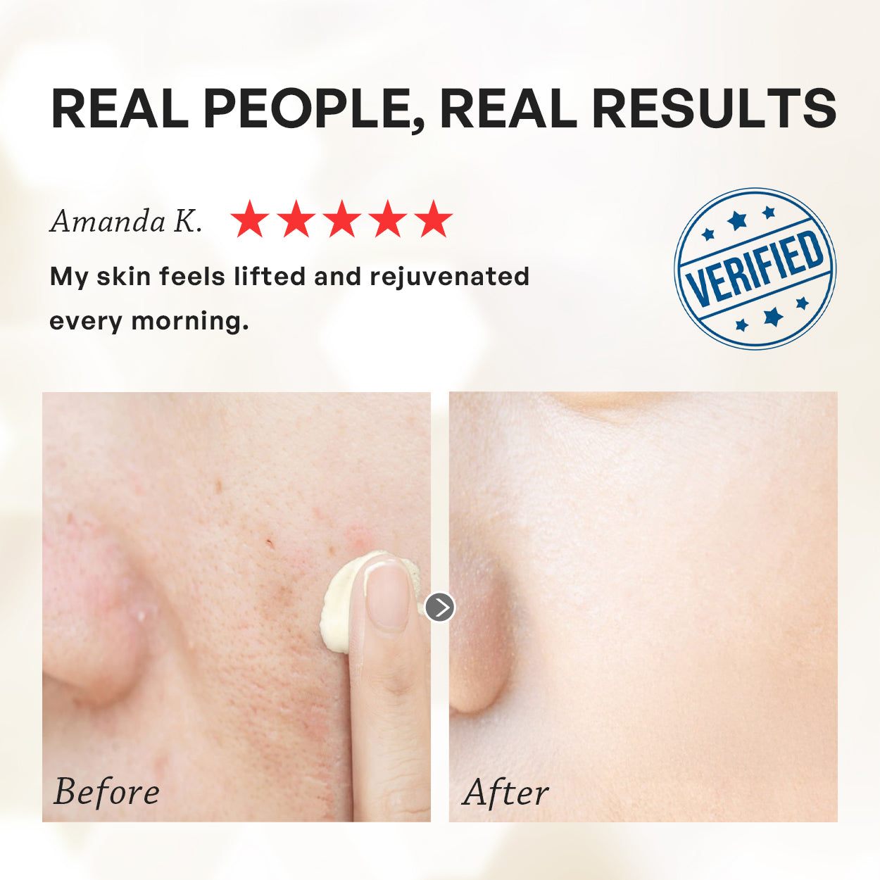 【TRUU】ExoRegenPro+™ Royal Jelly Youth Renewal Cream