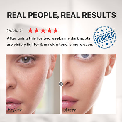 【TRUU】Intensive Whitening Dark Spot Corrector