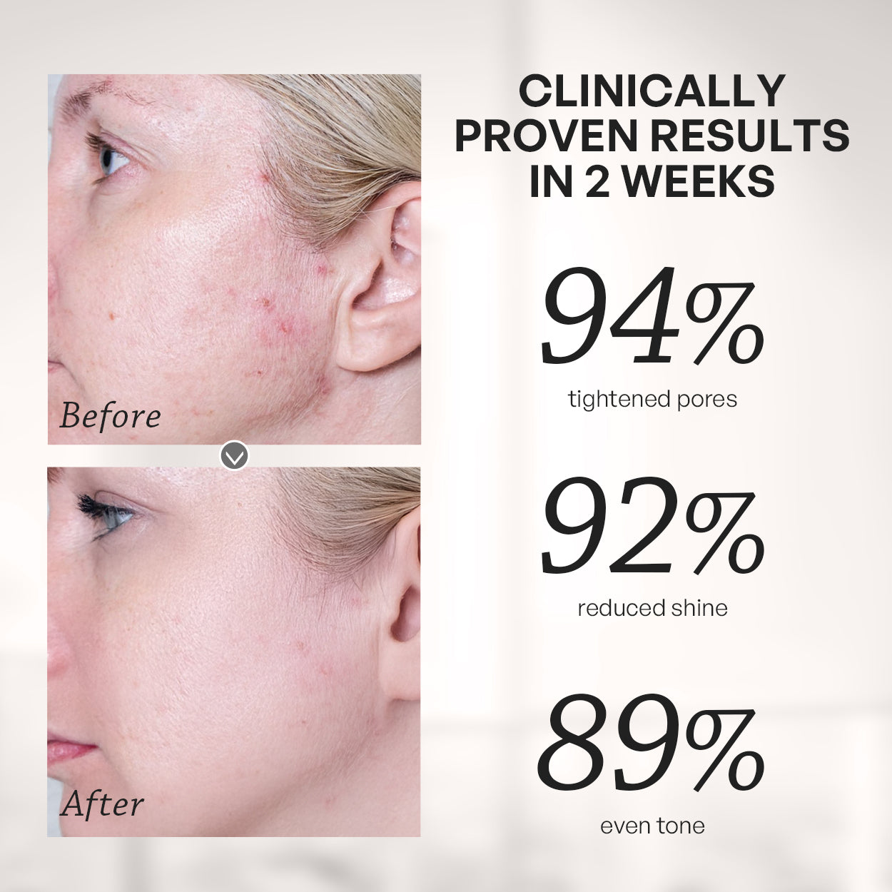 【TRUU】PDRN Salicyclic Pore Tightening Essence Toner