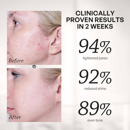 【TRUU】PDRN Salicyclic Pore Tightening Essence Toner