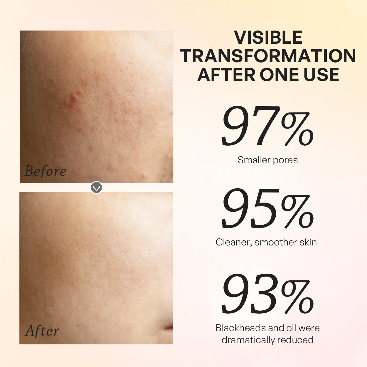 【TRUU】Gold Brightening Treatment Mask