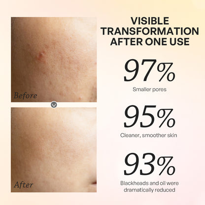 【TRUU】Gold Brightening Treatment Mask