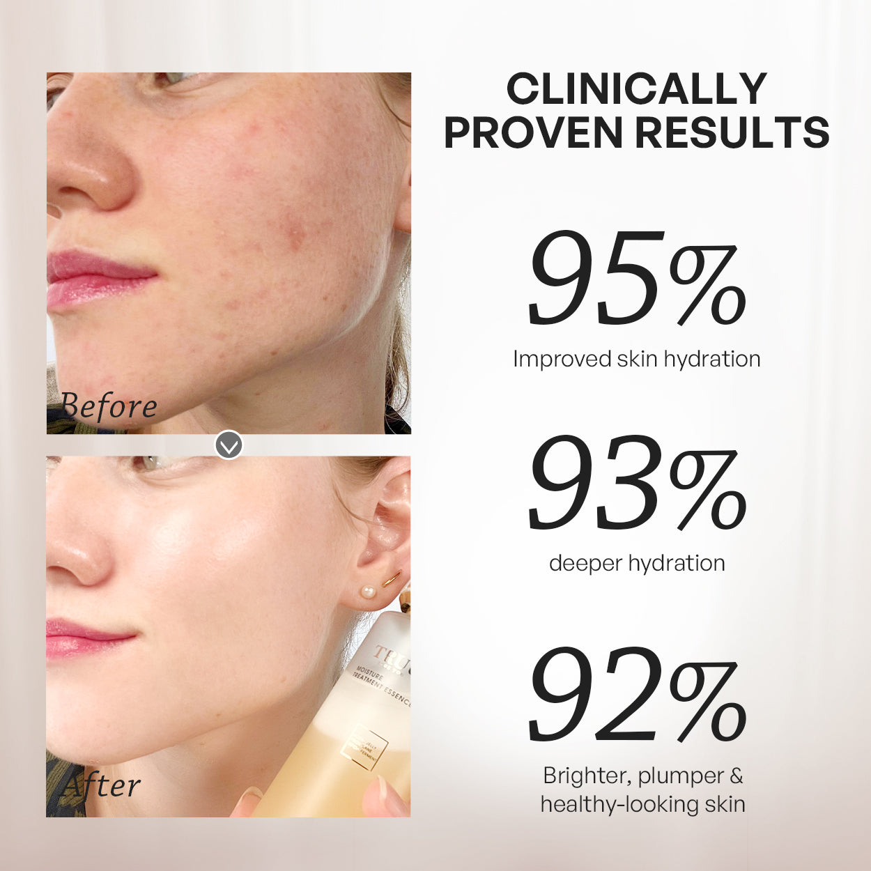 【TRUU】Royal Jelly Moisture Treatment Essence