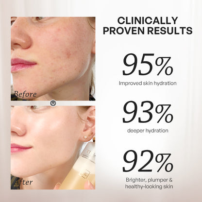 【TRUU】Royal Jelly Moisture Treatment Essence