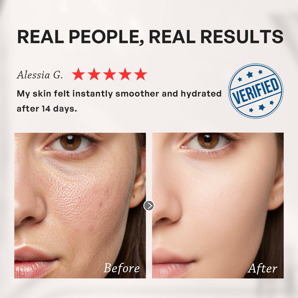 【TRUU】Copper Peptide Hyaluronic Hydrating Repair Essence