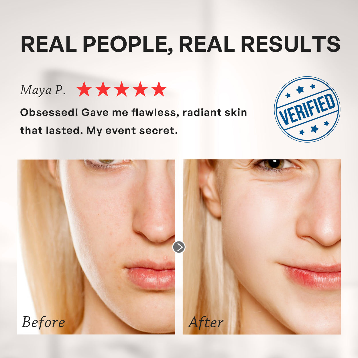 【TRUU】PDRN外泌體膠原再生水光面膜