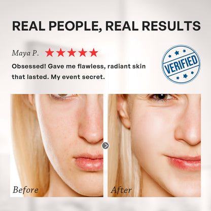 【TRUU】PDRN外泌體膠原再生水光面膜