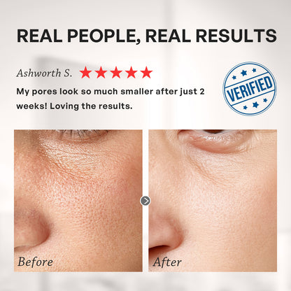 【TRUU】PDRN Salicyclic Pore Tightening Essence Toner