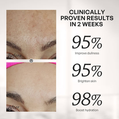 【TRUU】Intensive Whitening Dark Spot Corrector