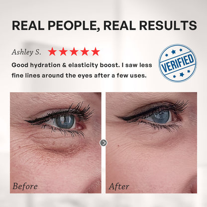 【TRUU】PDRN ExoRegenPro+™ Intensive Firming & Brightening Eye Mask