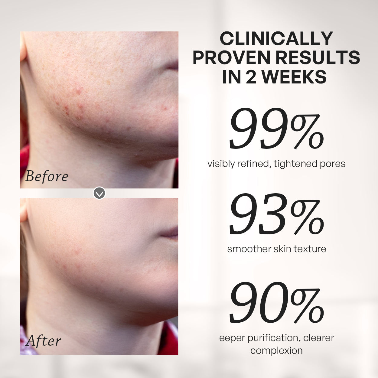 【TRUU】2% Salicylic Acid Pore Minimising Bubble Mask