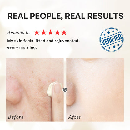 【TRUU Free Shipping & Buy 3 Get 4 Free】【Anti-Aging Repair Set】Royal Jelly Moisture Treatment Essence + Pro Perfection Repair Essence + ExoRegenPro+™ Royal Jelly Youth Renewal Cream【Free】Snow Gentian Cream-10g + PDRN Glow Mask-30G +Ampoule Mask*2