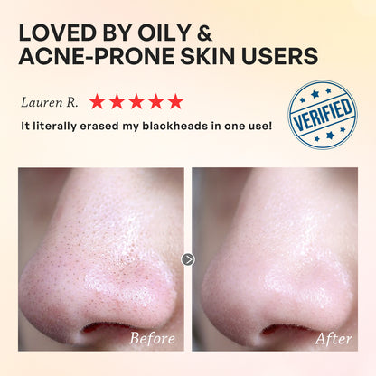 【TRUU】Gold Brightening Treatment Mask