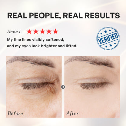 【TRUU】Luxe Gold Peptide Firming Eye Cream