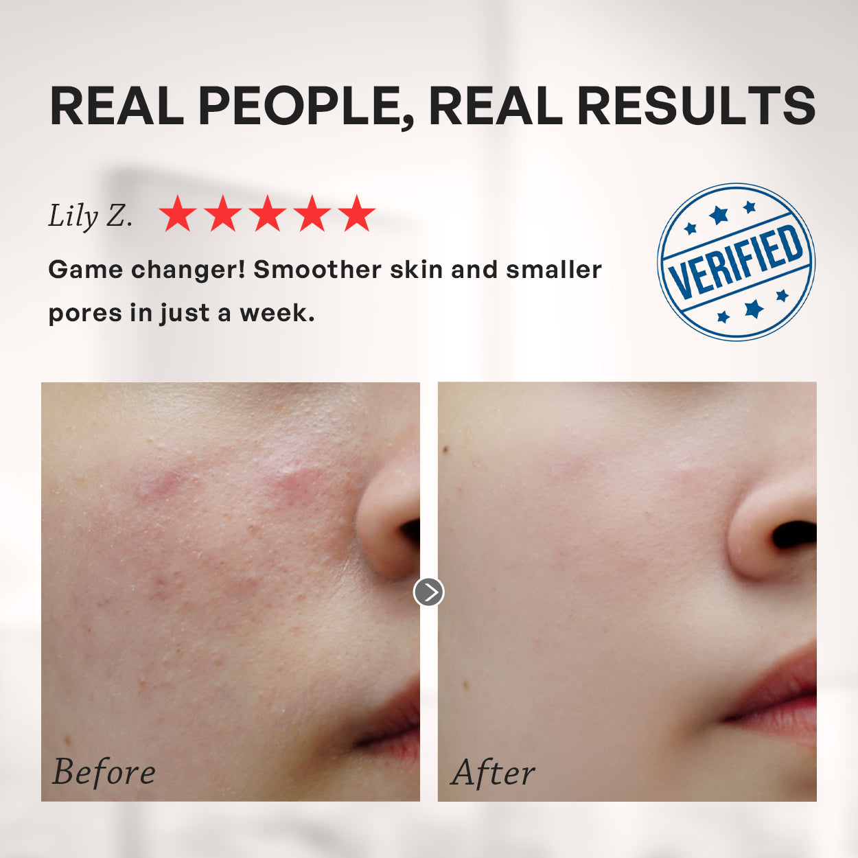 【TRUU】Succinic Acid Clarifying Treatment Mask