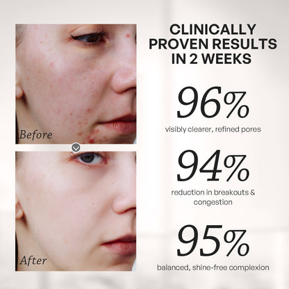 【TRUU Buy 2 Get 1 Free】(76 Probiotics Amino Purifying Cleanser/76 Probiotic Salicylic Purifying Cleanser) Pick 2【Free】ExoRegenPro+™ Supercharged Whitening Essence Toner-30ML Travel Size