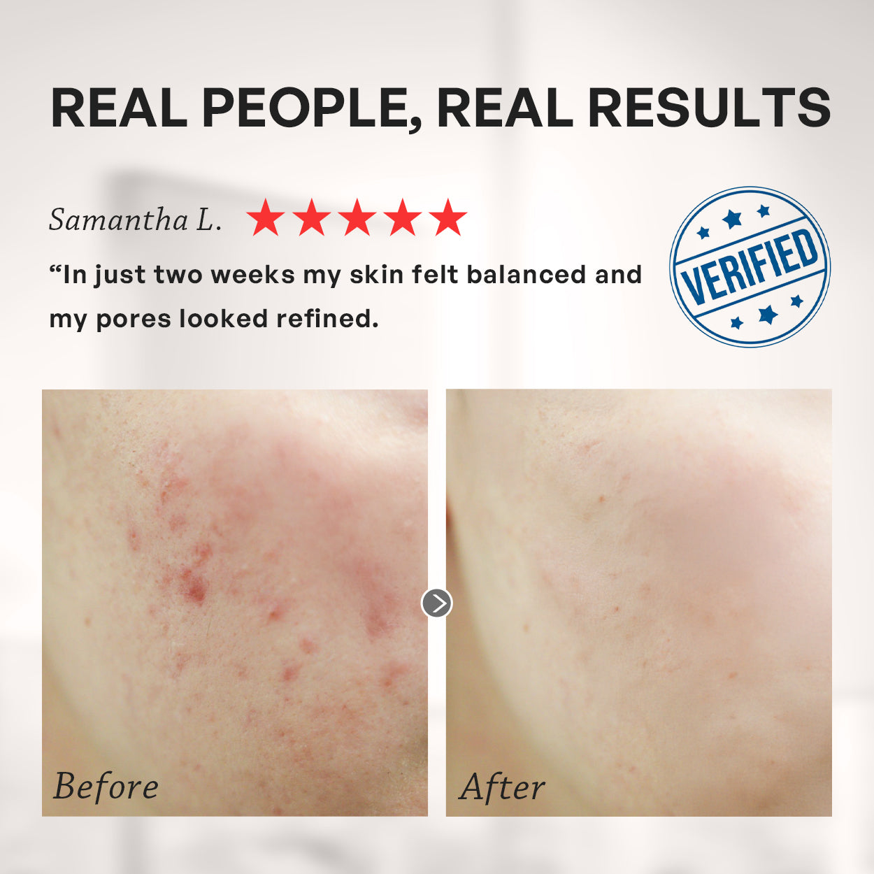 【TRUU Buy 2 Get 1 Free】(76 Probiotics Amino Purifying Cleanser/76 Probiotic Salicylic Purifying Cleanser) Pick 2【Free】ExoRegenPro+™ Supercharged Whitening Essence Toner-30ML Travel Size