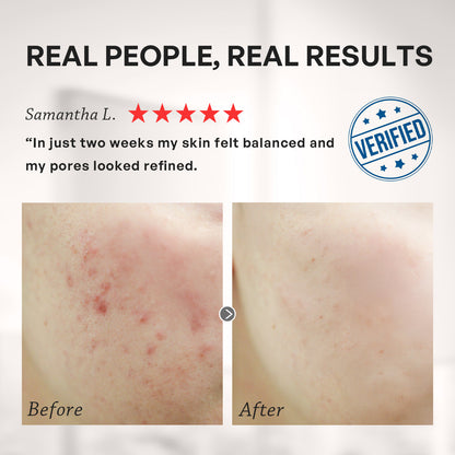 【TRUU Buy 2 Get 1 Free】(76 Probiotics Amino Purifying Cleanser/76 Probiotic Salicylic Purifying Cleanser) Pick 2【Free】ExoRegenPro+™ Supercharged Whitening Essence Toner-30ML Travel Size