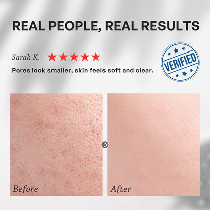 【TRUU】99 Oil-Control Moisture Balancing Cream