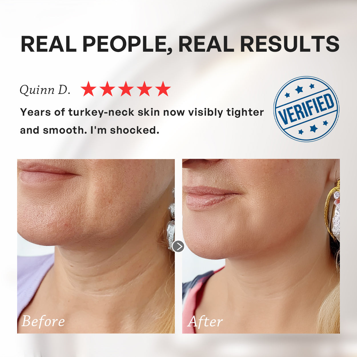 【TRUU】PDRN ExoRegenPro+™ Anti-Wrinkle Firming Neck Cream