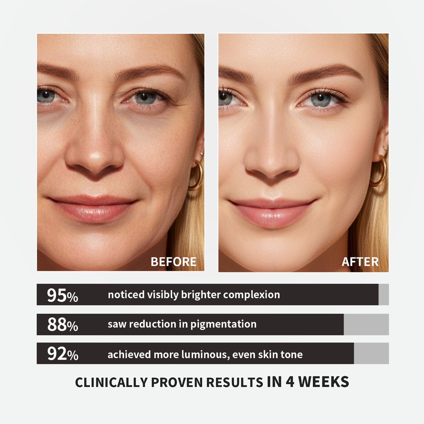 【ALLRE】日本專利穀胱甘肽奢白膠囊 (30粒/袋)