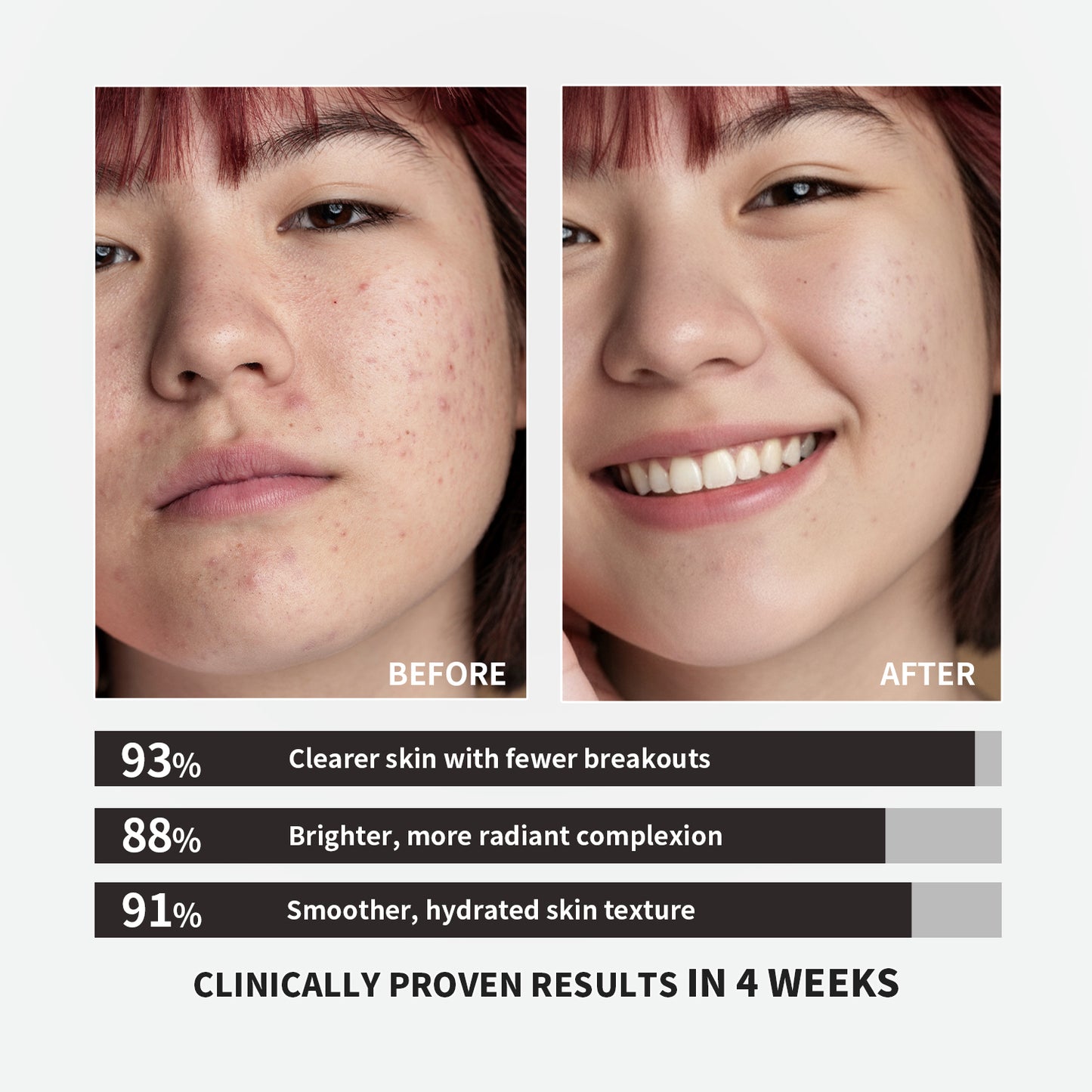 【ALLRE】Inner Balance Skin Calming Beauty Repair Capsule (30 capsules/bag)