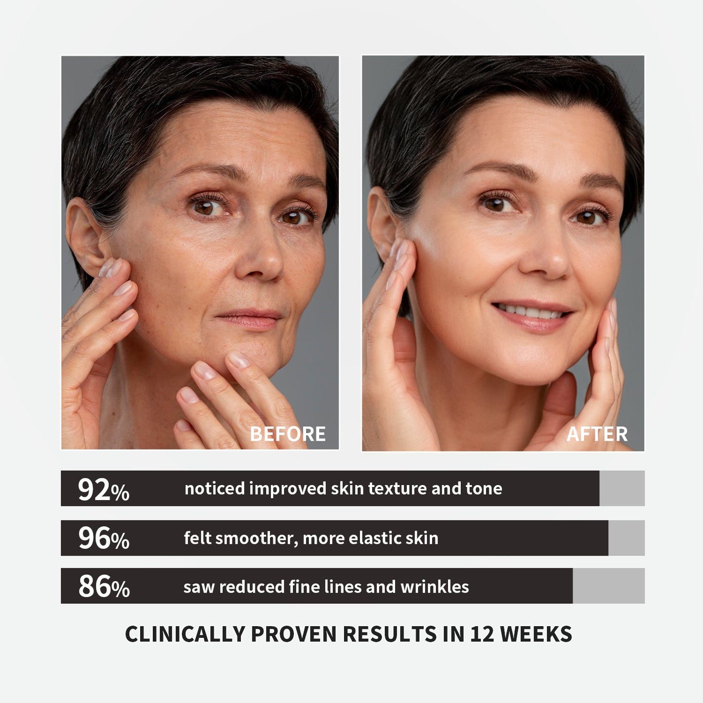 【ALLRE】French Pine Bark Time Capsule-7 days packs