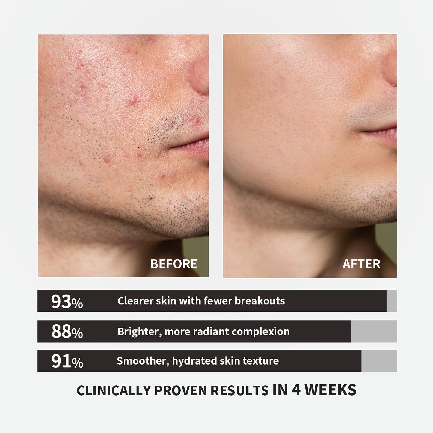 【ALLRE】Inner Balance Skin Calming Beauty Repair Capsule (30 capsules/bag)