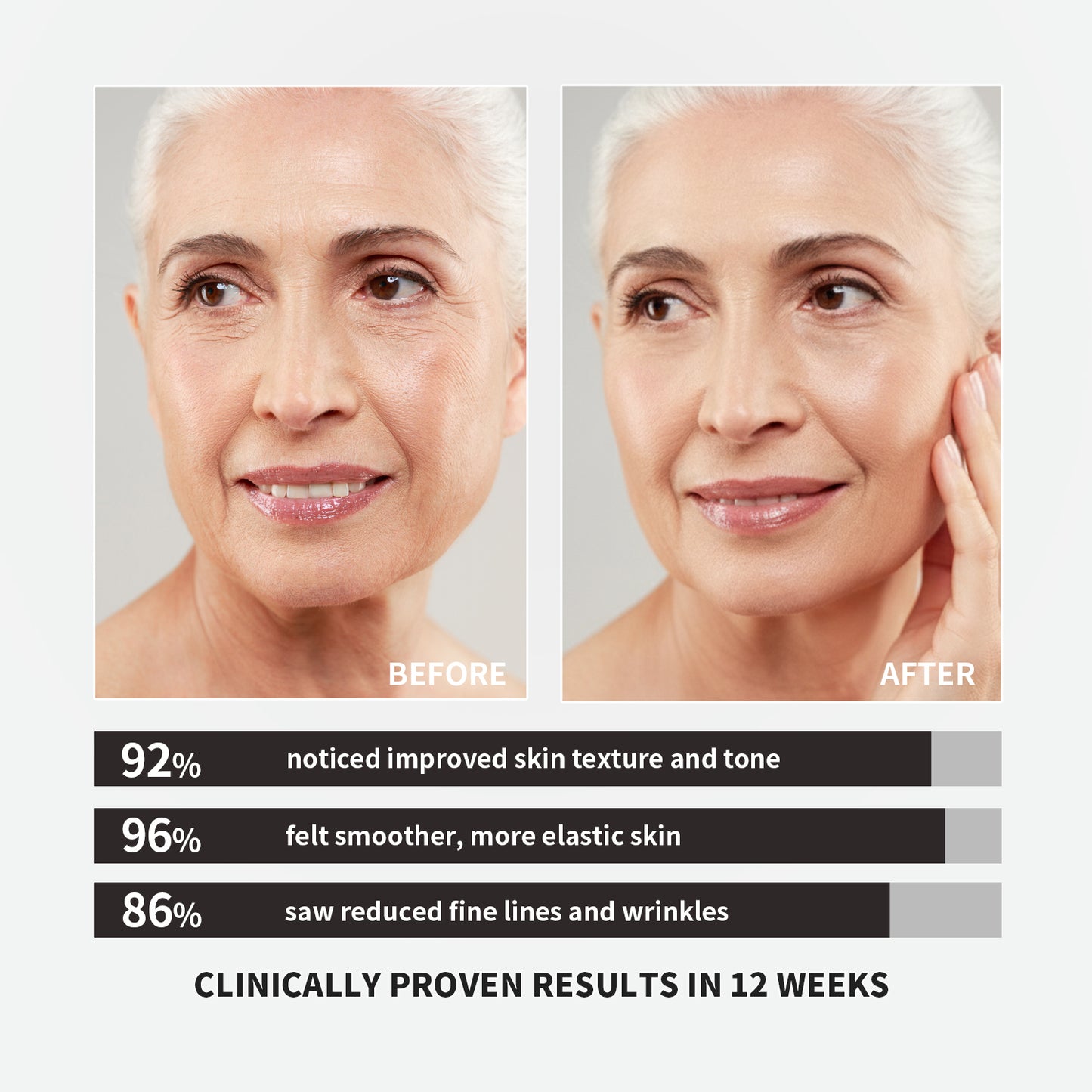 【ALLRE】French Pine Bark Time Capsule-7 days packs