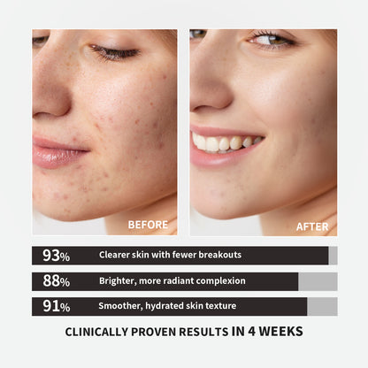 【ALLRE】Inner Balance Skin Calming Beauty Repair Capsule (30 capsules/bag)