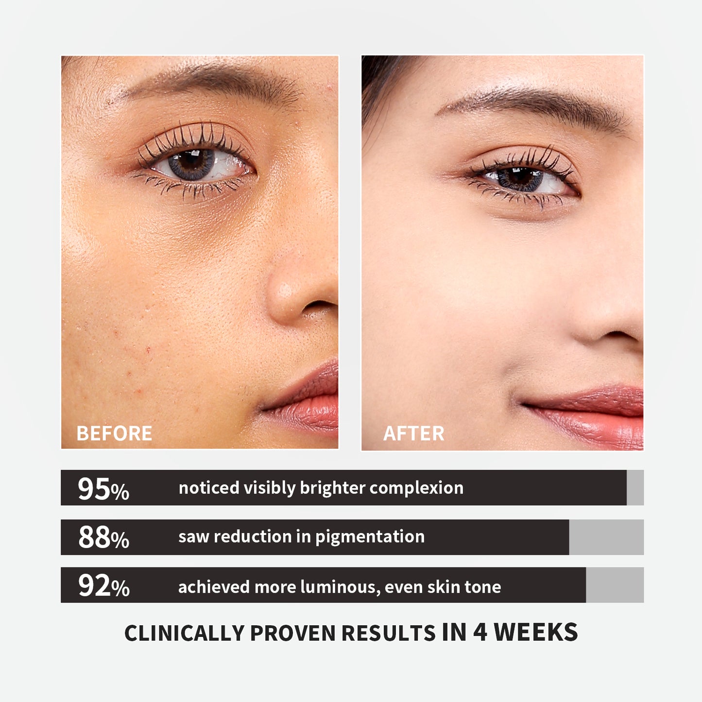 【ALLRE】日本專利穀胱甘肽奢白膠囊 (30粒/袋)