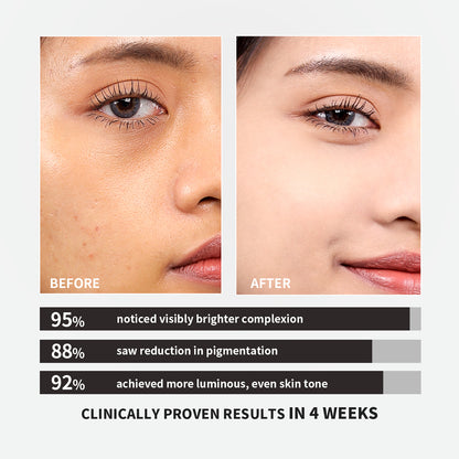 【ALLRE】日本專利穀胱甘肽奢白膠囊 (30粒/袋)